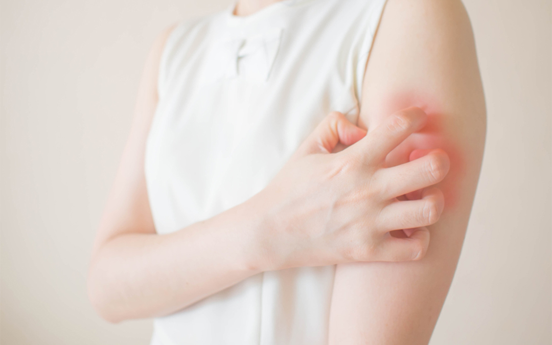 Skin Rash Treatment - Skin Specialist Singapore