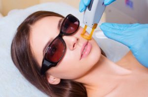 Laser Treatment