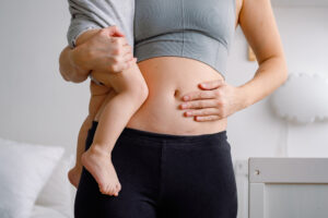 Cryolipolysis-After-Pregnancy