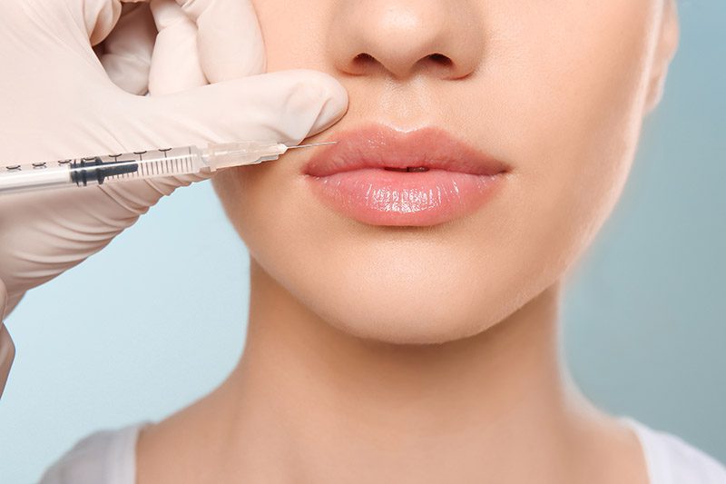You are currently viewing Dermal Fillers